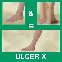 Гольфы компрессионные Sigvaris "Ulcer-X  KIT", 2 класс компрессии, с открытым носком