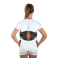 Ортез рамочный гиперэкстензионный Orliman